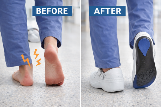 SoleMD Pro Arch Support Insoles